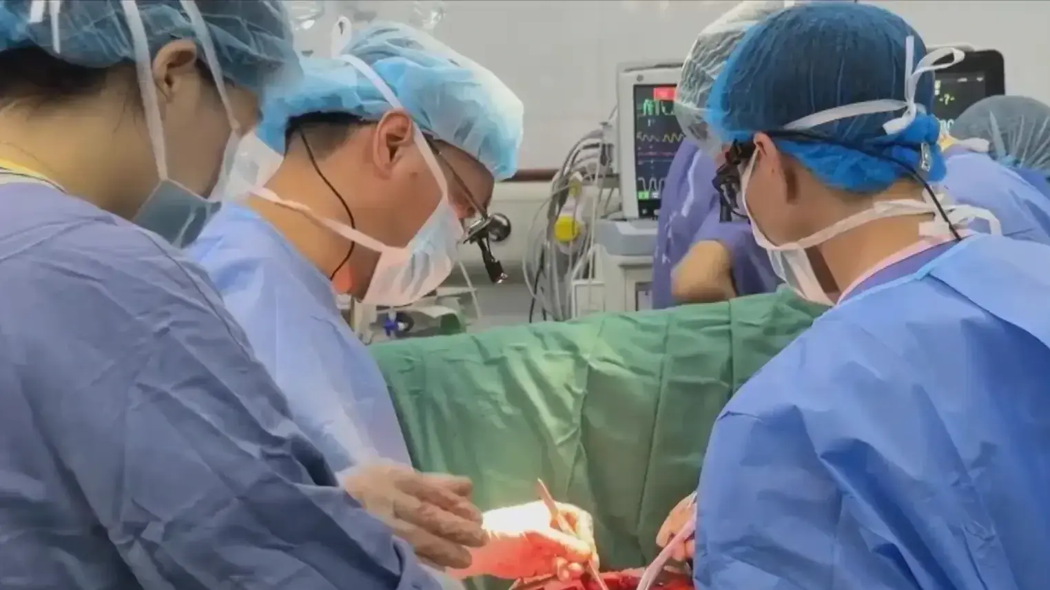 Ghép tạng Việt Nam hành trình nối dài sự sống